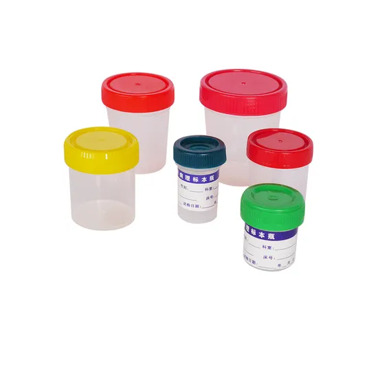 Bộ ph&acirc;n t&iacute;ch Devimen Deli Delicer Chất lượng cao ODM Ph&acirc;n t&iacute;ch Huyết học Huyết học Petri Mẫu vật chứa